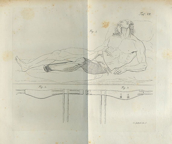 Carl Caspar Créve - 2 Werke über das weibliche Becken. 1794-95.